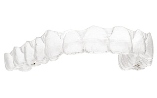 Aligner-Schiene Aligner-Schiene